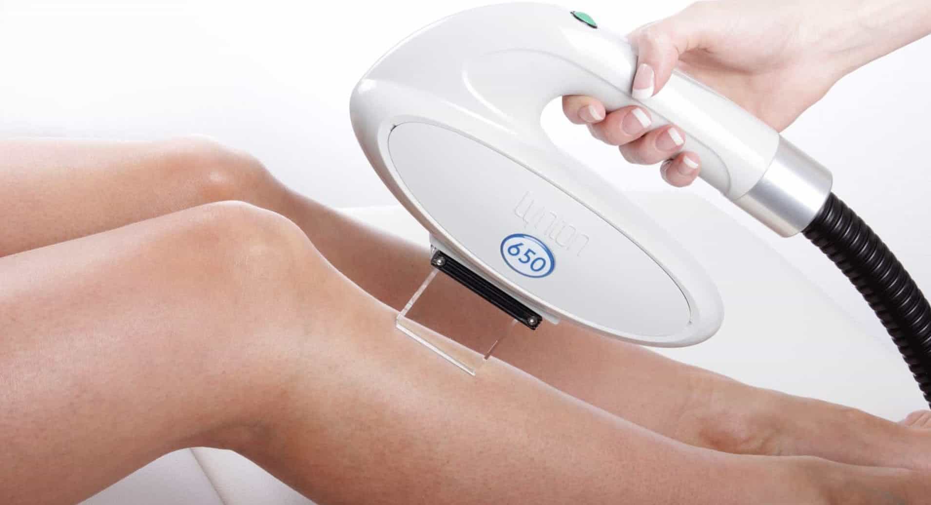 woman getting laser hair removal on legs