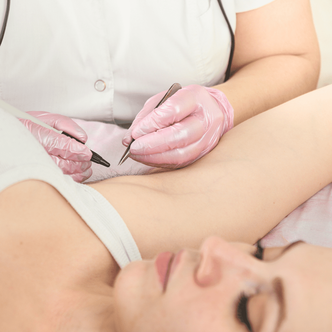 Permanent Hair Removal | Devin Electrolysis of Norwood, MA